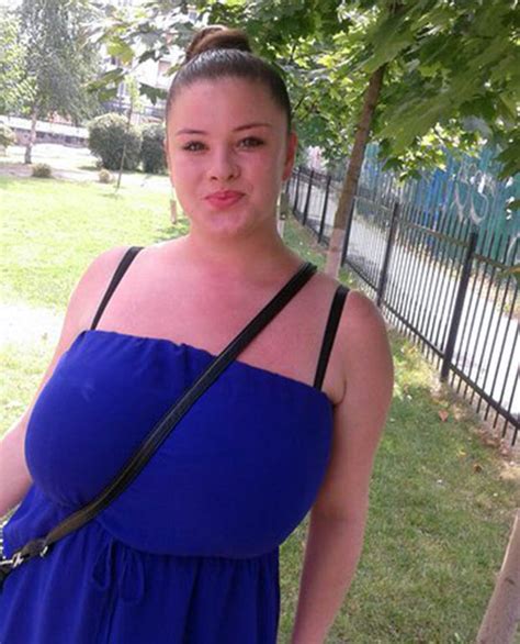 Size 8 teenager, 19, with natural 34I breasts insists they're a 'curse' and have led to 'cruel' taunts and severe back problems as she crowdfunds £5,000 for reduction surgery. Vicky Rog, 19, from ...